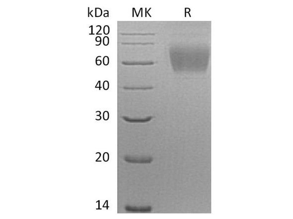 Human SIGLEC9/CD329 Recombinant Protein (RPES4997)