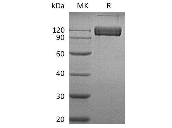 Human ALCAM/CD166 Recombinant Protein (RPES5006)