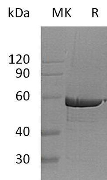 Human G6PD Recombinant Protein (RPES5007)