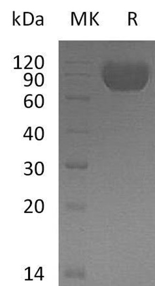 Human MAG/Siglec-4a Recombinant Protein (RPES5008)