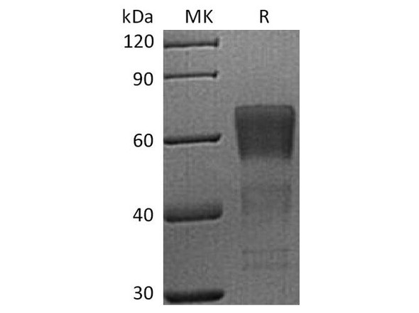 Human CD28/TP44 Recombinant Protein (RPES5016)