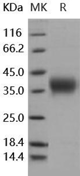 Human Activin RIIA/ACVR2A Recombinant Protein (RPES5020)