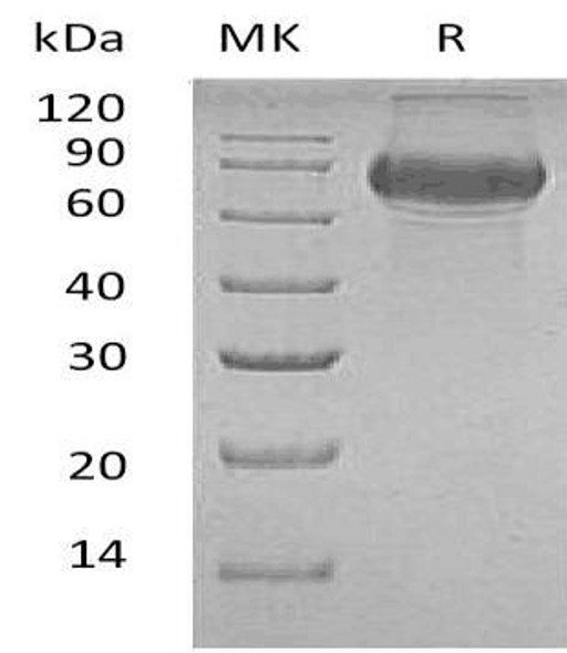Human CD19/Leu2 Recombinant Protein (RPES5026)