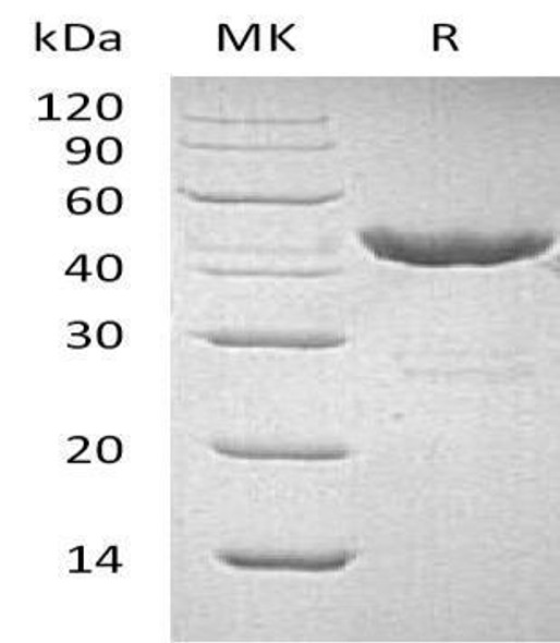 Human GOT1 Recombinant Protein (RPES5027)