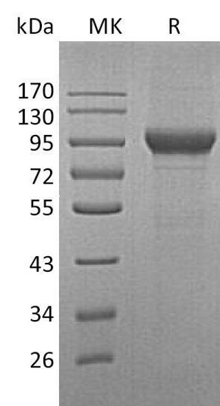 Human Myeloperoxidase/MPO Recombinant Protein (RPES5028)