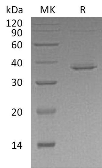 Human STAT5B Recombinant Protein (RPES5029)