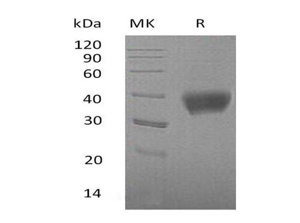 Mouse SIGLEC3/CD33 Recombinant Protein (RPES5034)