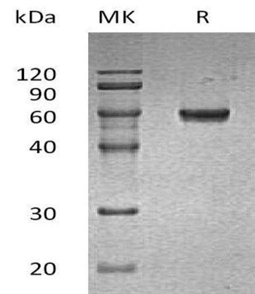 Human GLUL Recombinant Protein (RPES5046)