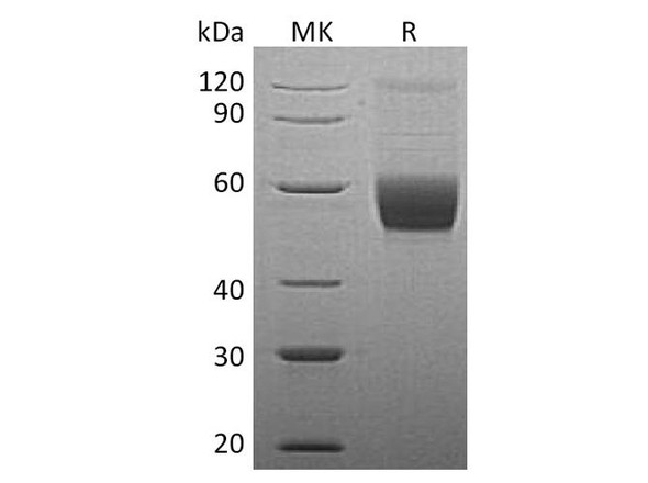 Human Vaspin/SerpinA12 Recombinant Protein (RPES5055)