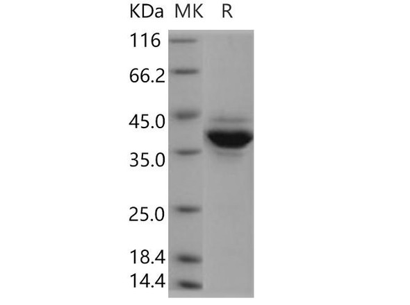 HJTB Recombinant Protein (RPES5057)