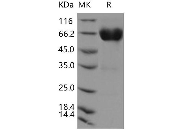 Human CD300a/LMIR1 Recombinant Protein (RPES5064)