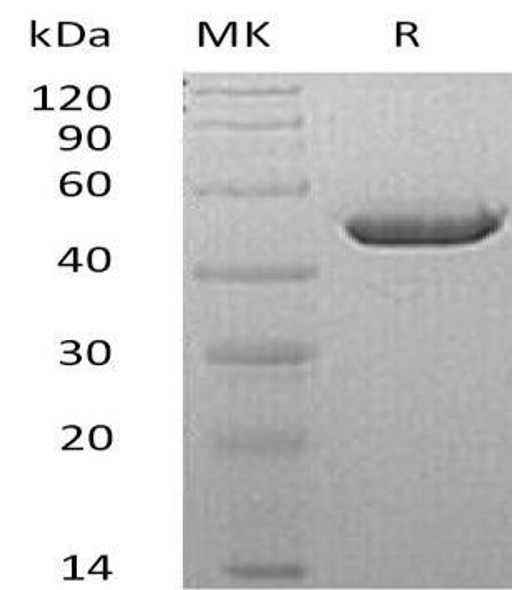 Mouse Carbonic Anhydrase 4 Recombinant Protein (RPES5071)