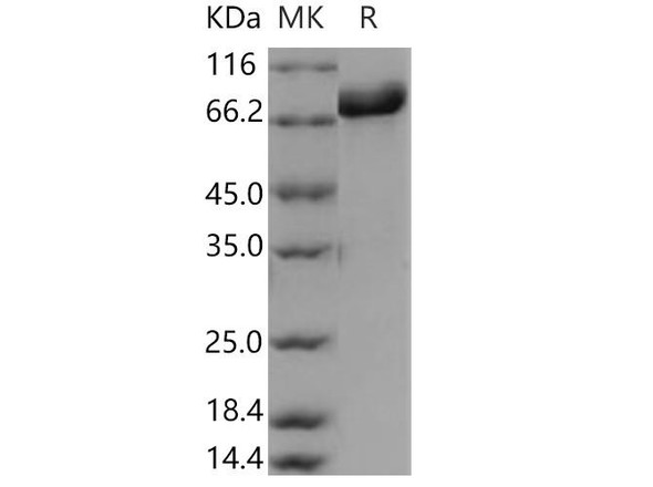 Dopamine beta-Hydroxylase Recombinant Protein (RPES5077)