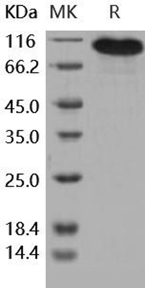 Human BCAM Recombinant Protein (RPES5079)