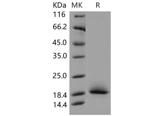 Mouse CD59a/MAC-IP Recombinant Protein (RPES5081)