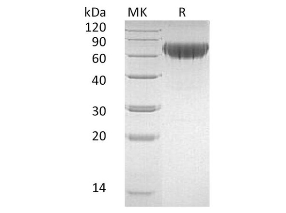 Human CD27/TNFRSF7 Recombinant Protein (RPES5085)