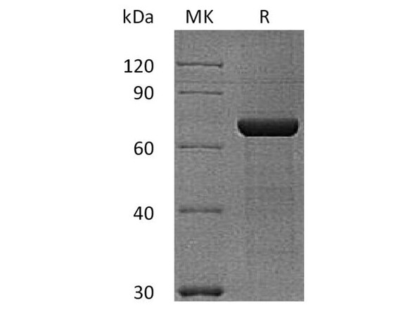 Human Semaphorin 3A/SEMA3A Recombinant Protein (RPES5094)