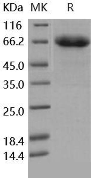 Human EphB4/HTK Recombinant Protein  (RPES5098)