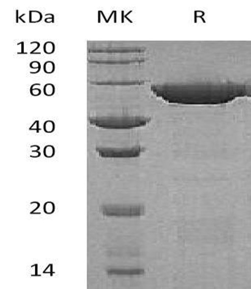 Human GSS Recombinant Protein (RPES5105)