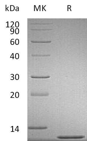 Mouse CCL2/MCP Recombinant Protein (RPES5109)