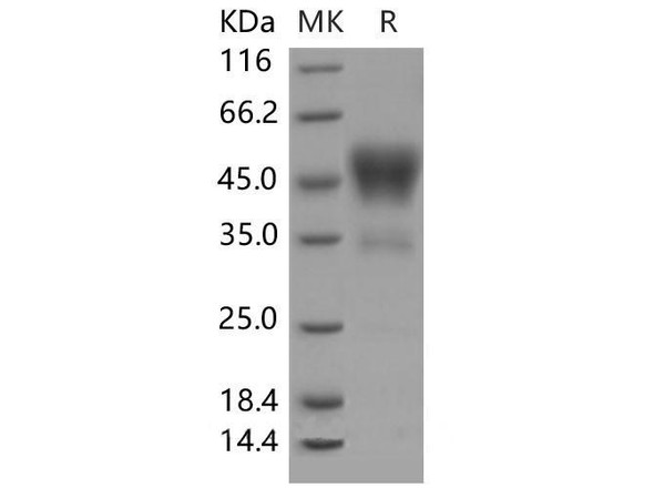 Mouse CD24 Recombinant Protein (RPES5120)