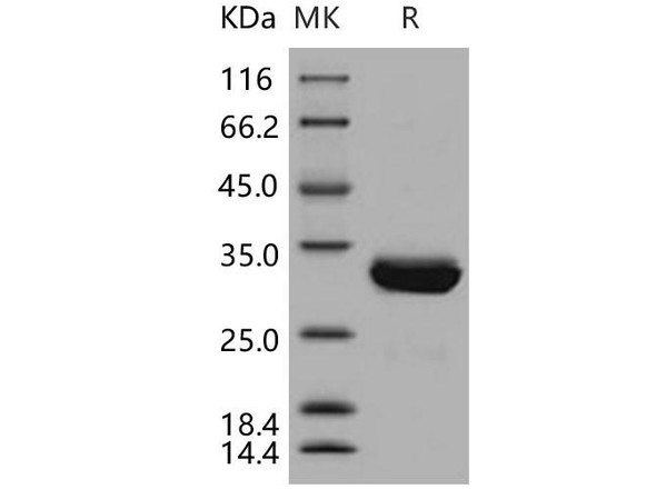 Human SCGN/Secretagogin Recombinant Protein (RPES5122)