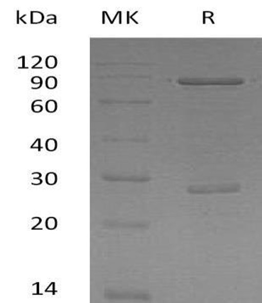 Human SMAD1 Recombinant Protein (RPES5127)