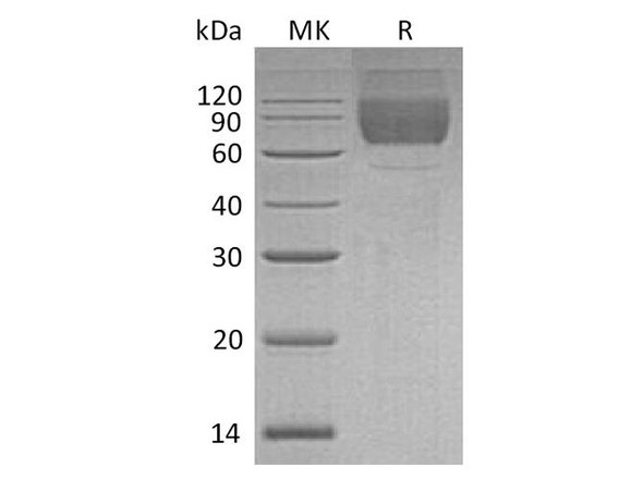 Human LIMP-2/LIMPII Recombinant Protein (RPES5133)