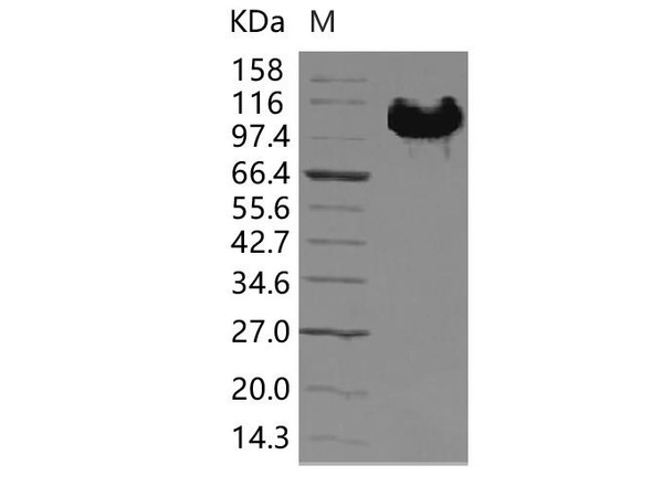 Human EphB4/HTK Recombinant Protein (RPES5137)