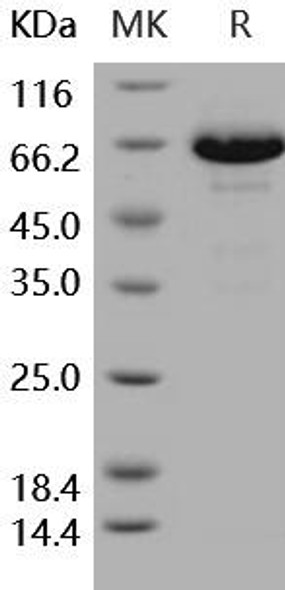 Human EphB6 Recombinant Protein (RPES5142)