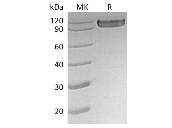 Human CD30/TNFRSF8 Recombinant Protein (RPES5143)