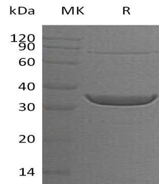 Human ACY3 Recombinant Protein (RPES5145)
