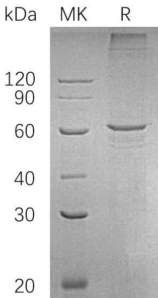 Human SMAD4 Recombinant Protein (RPES5146)