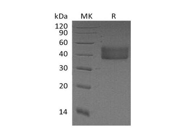 Mouse Factor D Recombinant Protein (RPES5151)