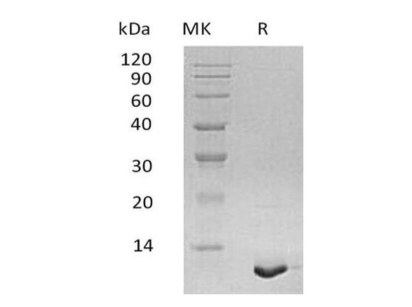 Human S100A12/CAGC Recombinant Protein (RPES5152)