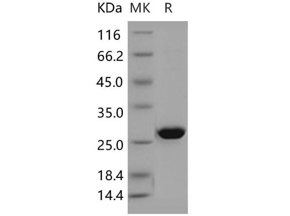 Human AK4/AK3L1 Recombinant Protein (RPES5161)