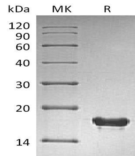 Human SUMO2 Recombinant Protein (RPES5166)