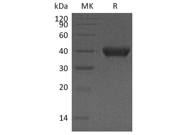 Human RNASET2 Recombinant Protein (RPES5172)