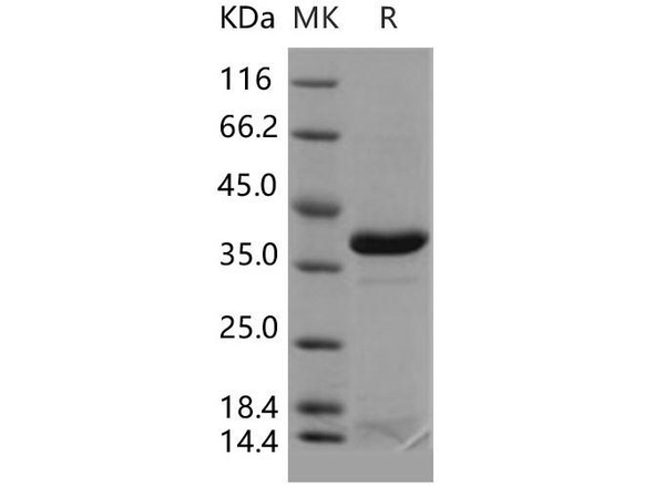 Human APE1/APE Recombinant Protein (RPES5180)