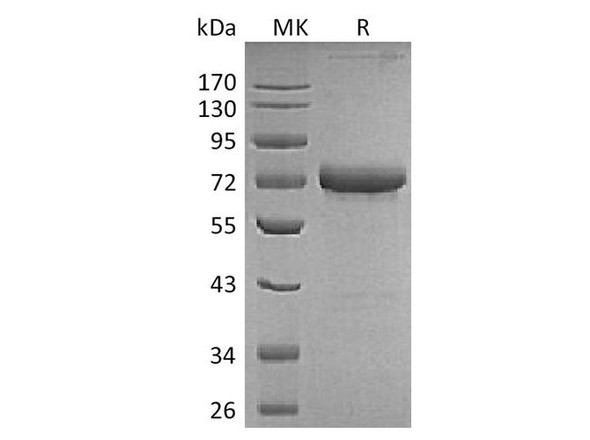 Human OX40/TNFRSF4 Recombinant Protein (RPES5192)