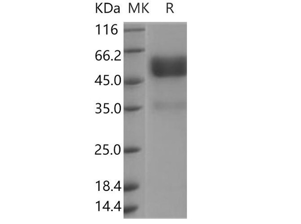 Human TNFRSF19/TROY Recombinant Protein (RPES5194)