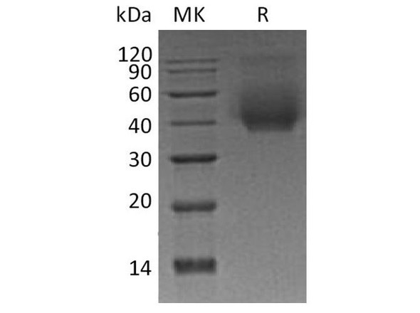 Human CD44 Recombinant Protein (RPES5202)