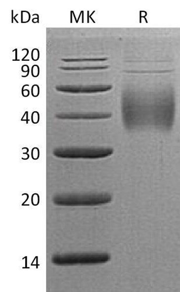 Human 2B4/CD244 Recombinant Protein (RPES5204)