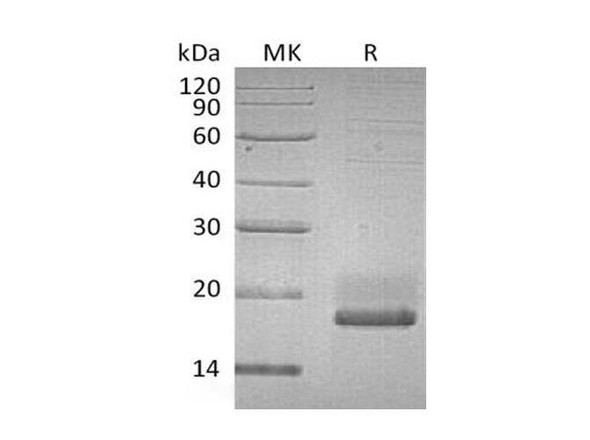 Human SUMO3/SMT3A Recombinant Protein (RPES5205)