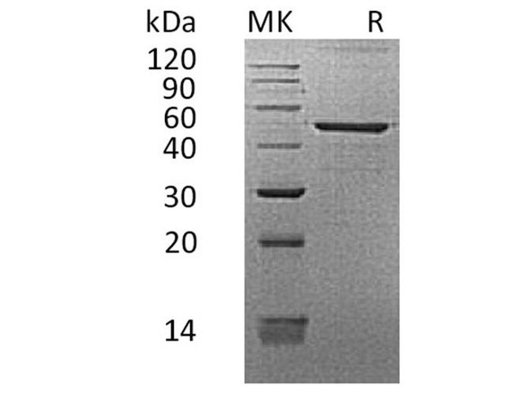 Human REG3G/PAPB Recombinant Protein (RPES5212)