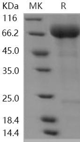 Human SIGLEC5 Recombinant Protein (RPES5215)