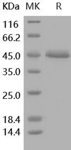 Human ALK-2/ACVR1 Recombinant Protein (RPES5217)
