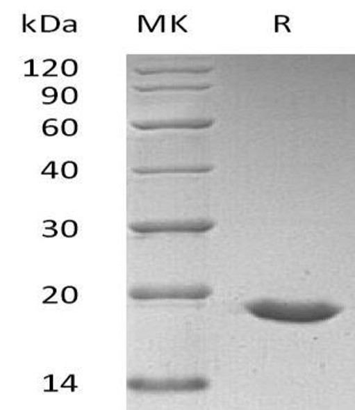 Human SUMO3/SMT3A Recombinant Protein (RPES5226)