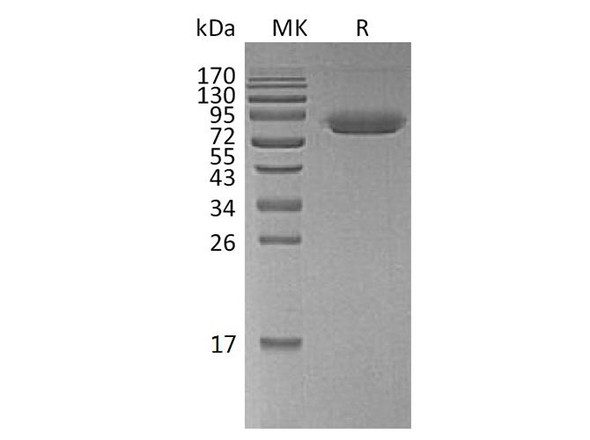 Human CD47/IAP Recombinant Protein (RPES5234)