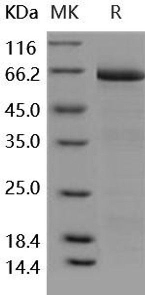 Human DCR3/TNFRSF6B Recombinant Protein (RPES5239)